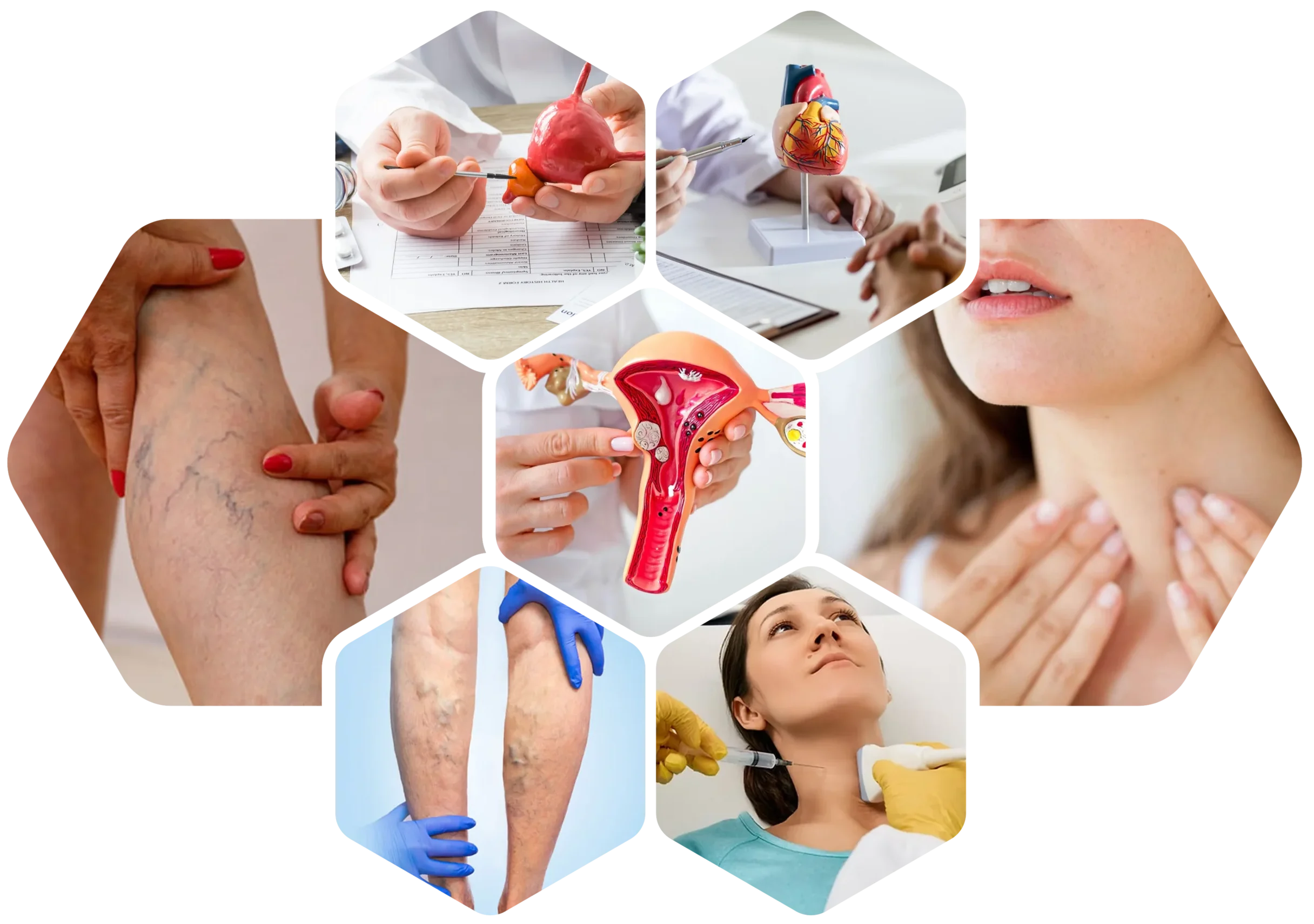 Collage of healthcare treatments including varicose vein care, heart, uterus, and thyroid consultations.