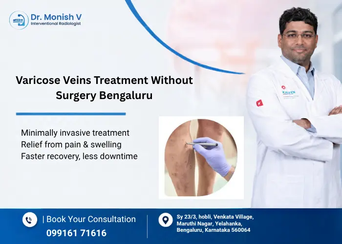 Blogs 1 Varicose Veins Treatment Without Surgery Bengaluru